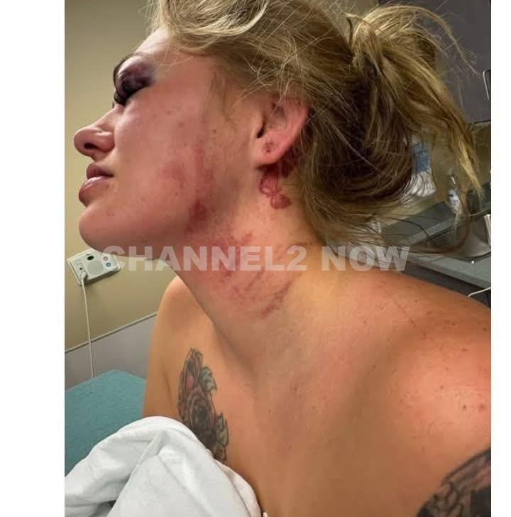 Dakota Sebring Seeks Justice After Surviving Severe Domestic Violence By Ex-Boyfriend Dalton Ridgeway-Williams