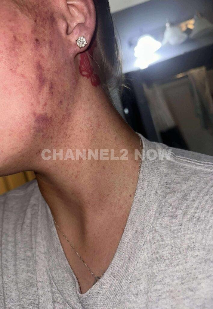 Dakota Sebring Seeks Justice After Surviving Severe Domestic Violence By Ex-Boyfriend Dalton Ridgeway-Williams