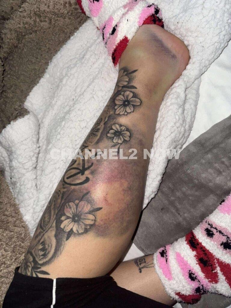 Dakota Sebring Seeks Justice After Surviving Severe Domestic Violence By Ex-Boyfriend Dalton Ridgeway-Williams