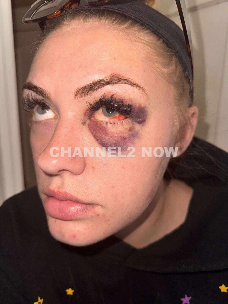 Dakota Sebring Seeks Justice After Surviving Severe Domestic Violence By Ex-Boyfriend Dalton Ridgeway-Williams