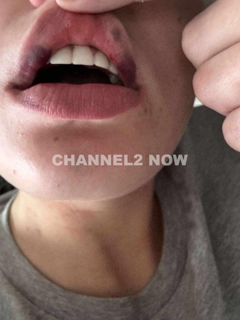 Dakota Sebring Seeks Justice After Surviving Severe Domestic Violence By Ex-Boyfriend Dalton Ridgeway-Williams