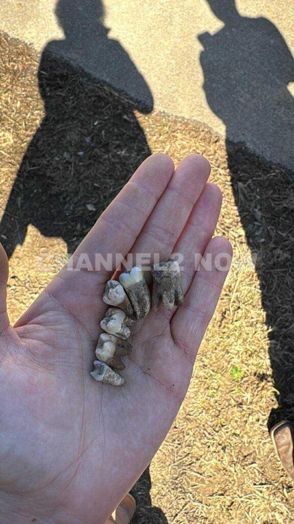Sevierville Homeowner Shaelyn Baggett Finds Human Teeth Emerging From Yard, Prompting Multi-Agency Investigation