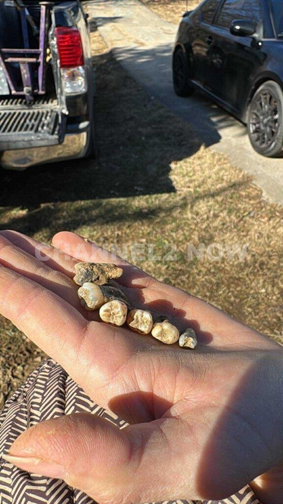 Sevierville Homeowner Shaelyn Baggett Finds Human Teeth Emerging From Yard, Prompting Multi-Agency Investigation