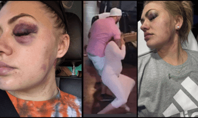 Dakota Sebring Seeks Justice After Surviving Severe Domestic Violence By Ex-Boyfriend Dalton Ridgeway-Williams Springfield