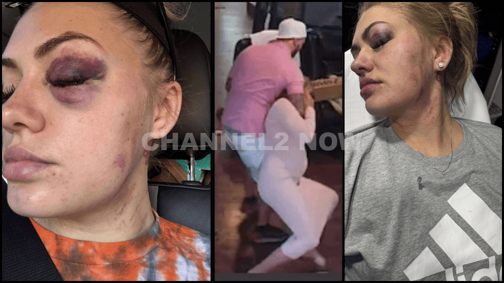 Dakota Sebring Seeks Justice After Surviving Severe Domestic Violence By Ex-Boyfriend Dalton Ridgeway-Williams Springfield