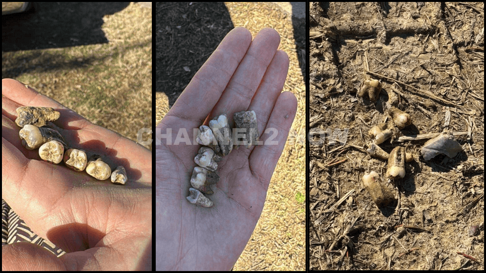 Sevierville Homeowner Shaelyn Baggett Finds Human Teeth Emerging From Yard, Prompting Multi-Agency Investigation